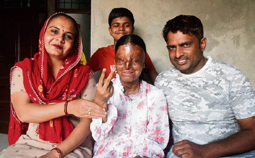 PRODIGIOUS : Acid attack survivor SECURES 95 percent marks